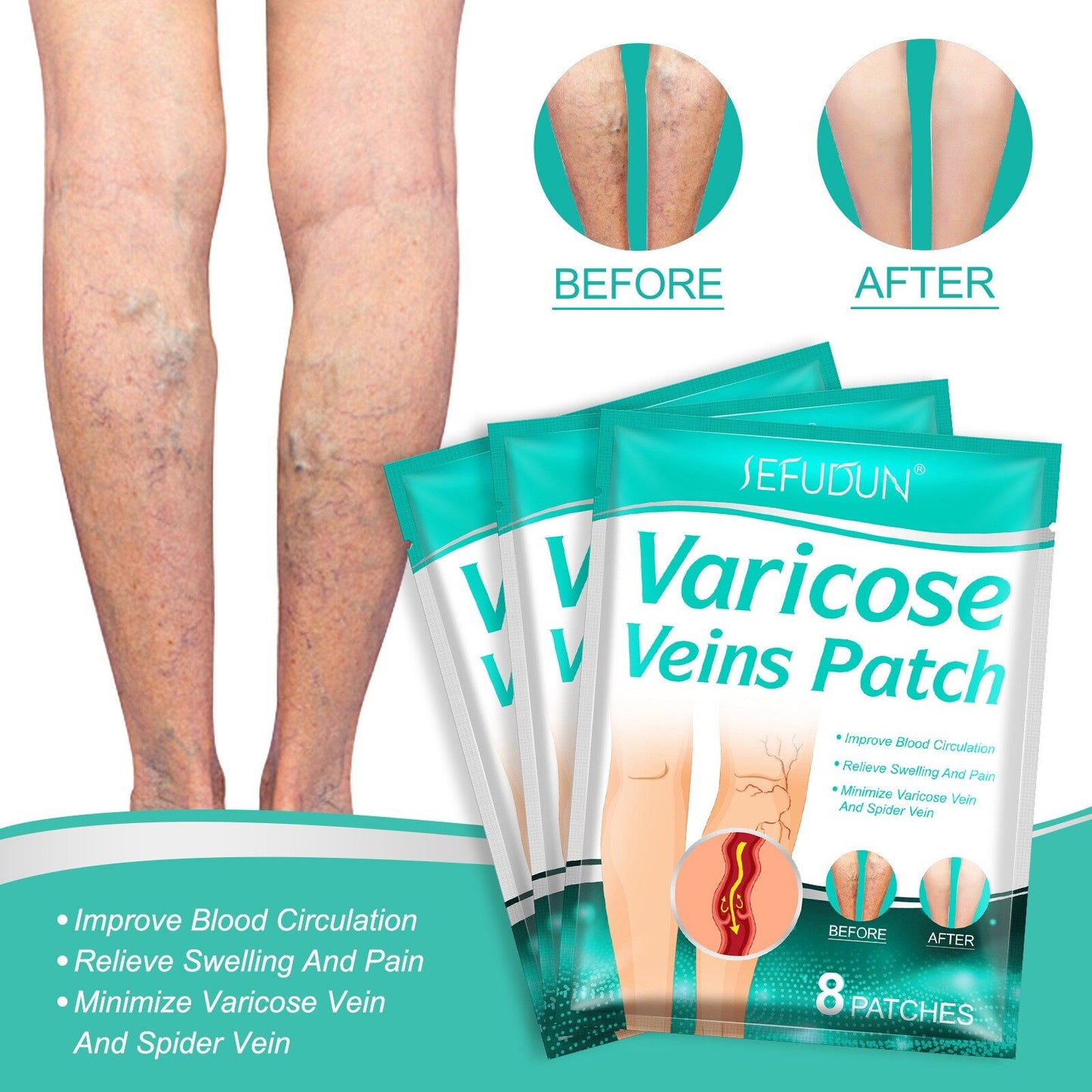 CremeVital Patches™ - Des jambes plus saines