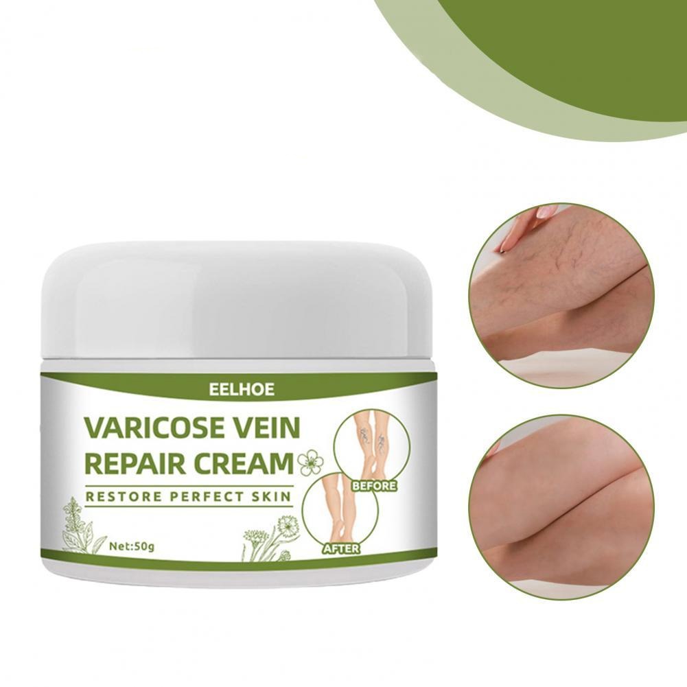 VeinCreme™ - crème anti-varices